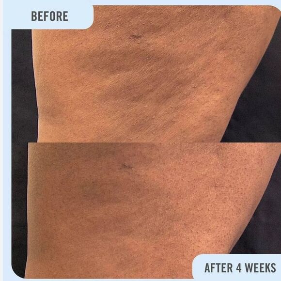 First Aid Beauty Sculpting Body Lotion - Picture 5 of 13